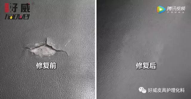 真皮修复